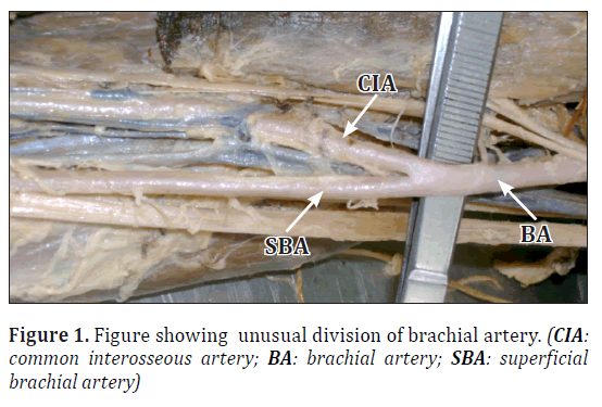 anatomical-variations-brachial-artery