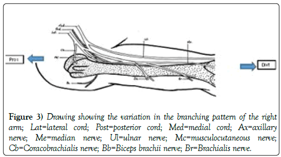 anatomical-variations-branching-pattern