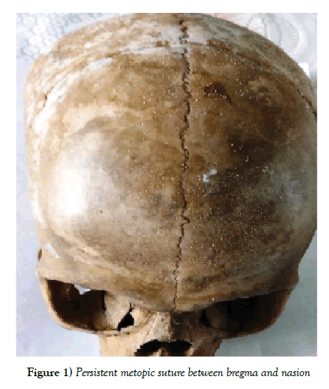 anatomical-variations-bregma-nasion