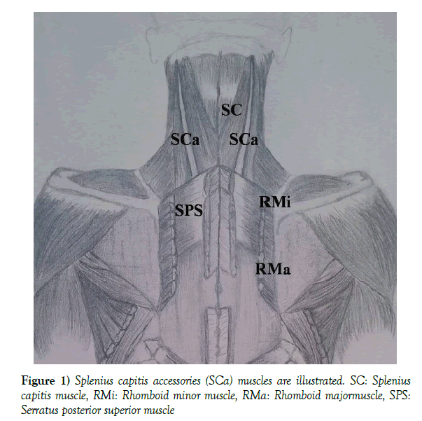 anatomical-variations-capitis-accessories