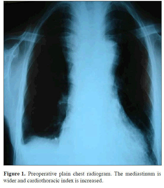 anatomical-variations-cardiothoracic