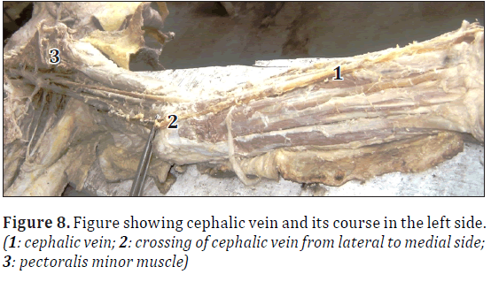 anatomical-variations-cephalic-course