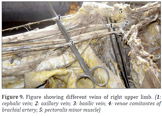 anatomical-variations-cephalic-course