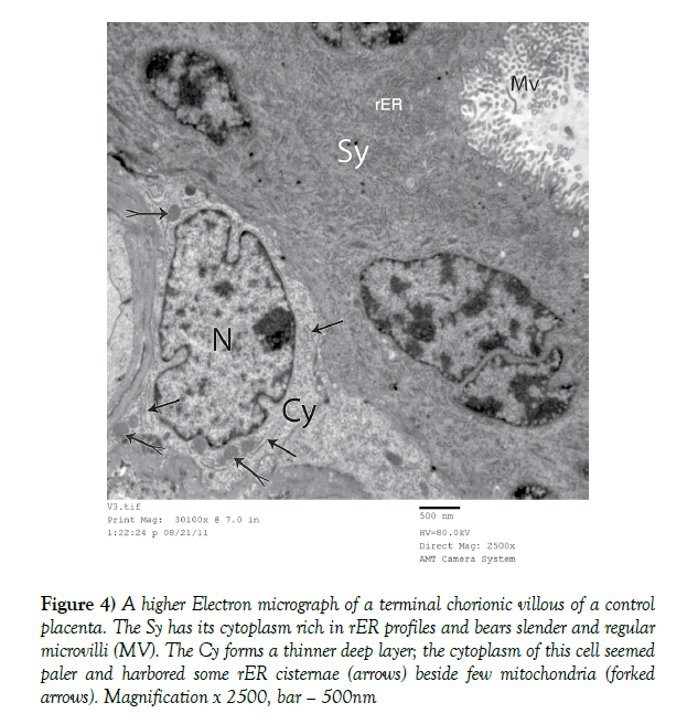 anatomical-variations-chorionic-villous