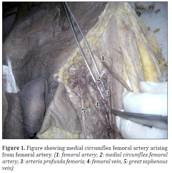 anatomical-variations-circumflex-femoral