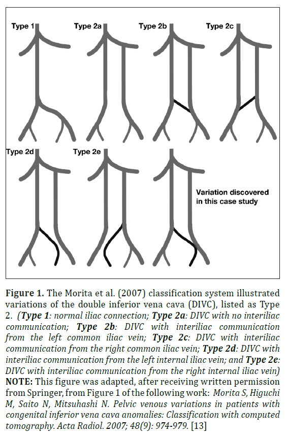 anatomical-variations-classification-system