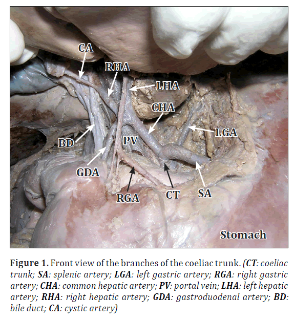 anatomical-variations-coeliac-trunk