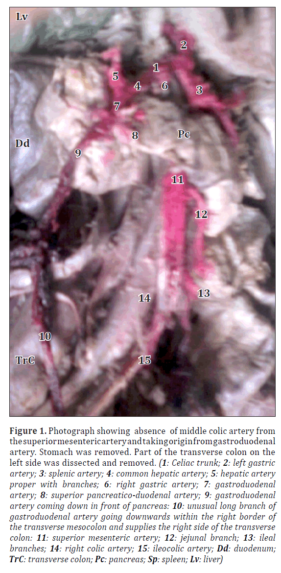 anatomical-variations-colic-artery
