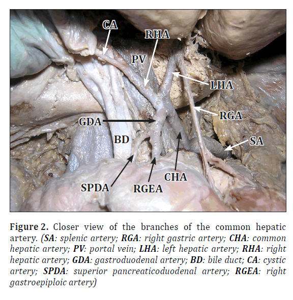 anatomical-variations-common-hepatic