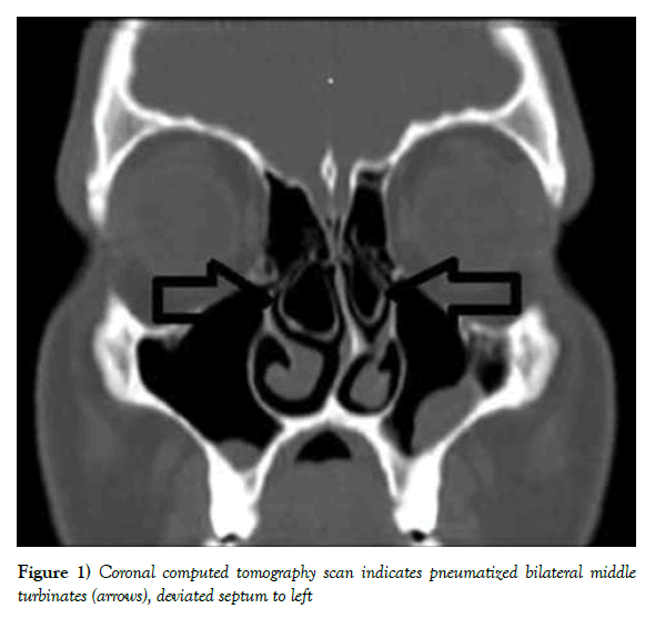 anatomical-variations-computed-tomography