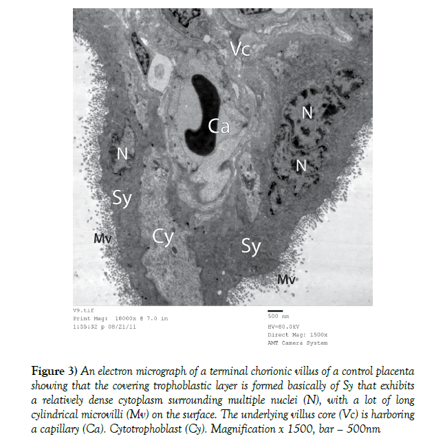 anatomical-variations-control-placenta