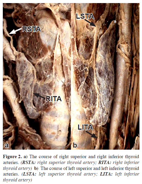 anatomical-variations-course-right