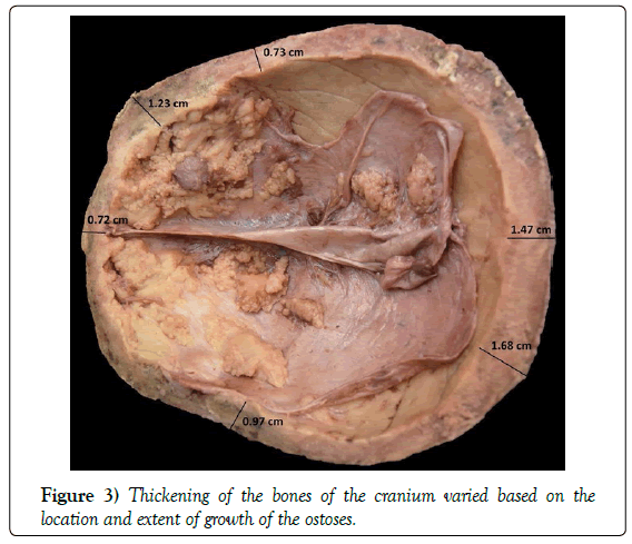 anatomical-variations-cranium-varied