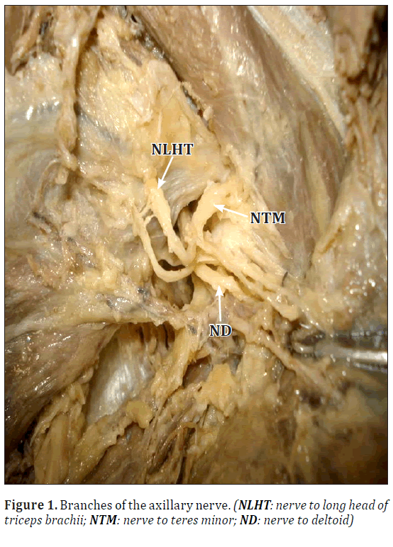 anatomical-variations-deltoid-nerve