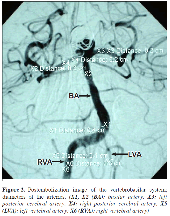 anatomical-variations-diameters