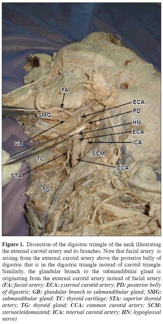 anatomical-variations-digastric-triangle