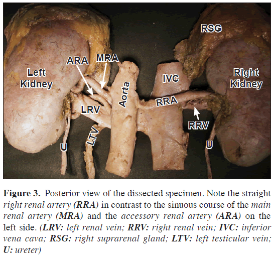 anatomical-variations-dissected