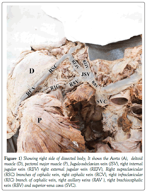 anatomical-variations-dissected-body