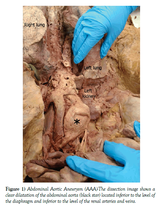 anatomical-variations-dissection-image