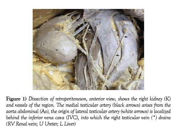 anatomical-variations-dissection-retroperitoneum