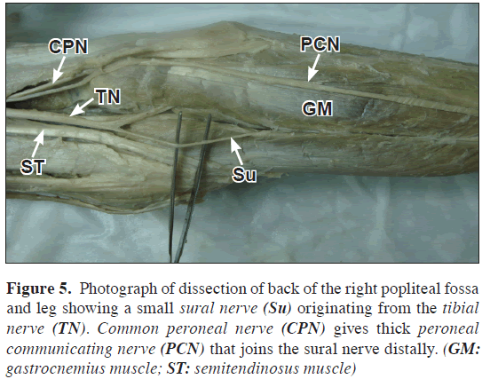 anatomical-variations-distally