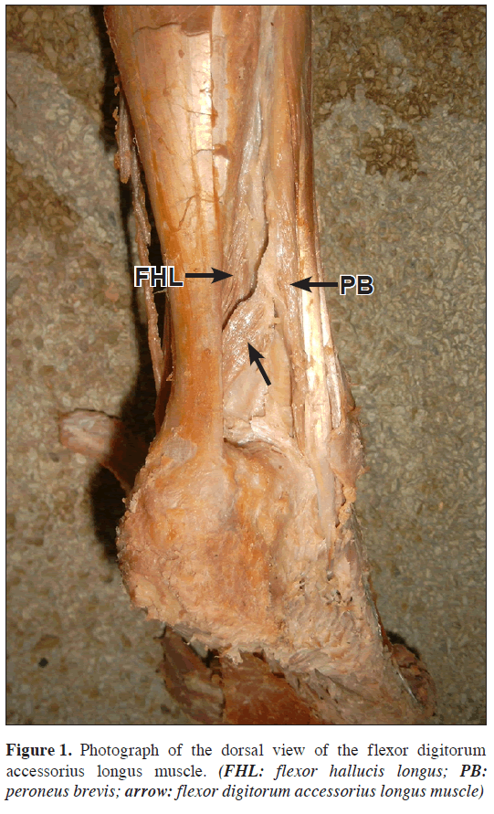 anatomical-variations-dorsal-view