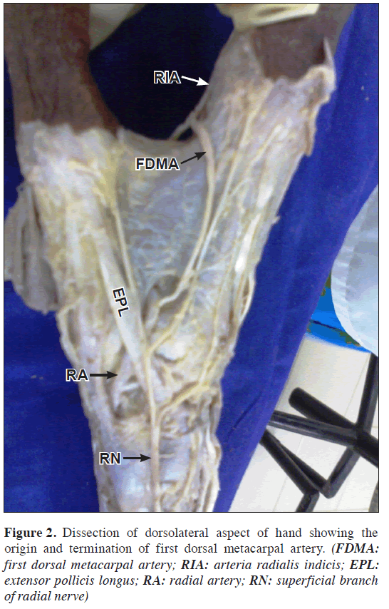 anatomical-variations-dorsolateral-aspect