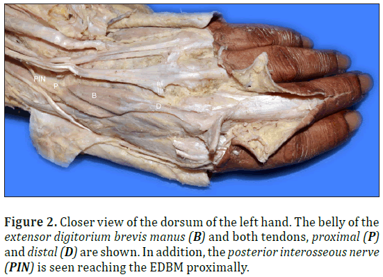 anatomical-variations-dorsum