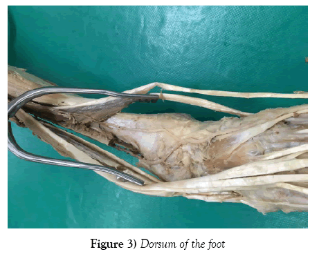 anatomical-variations-dorsum-foot