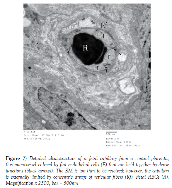 anatomical-variations-endothelial-cells