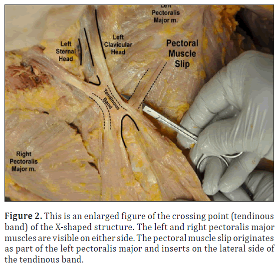 anatomical-variations-enlarged-figure