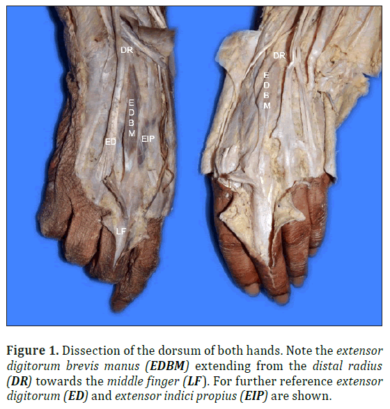 anatomical-variations-extensor