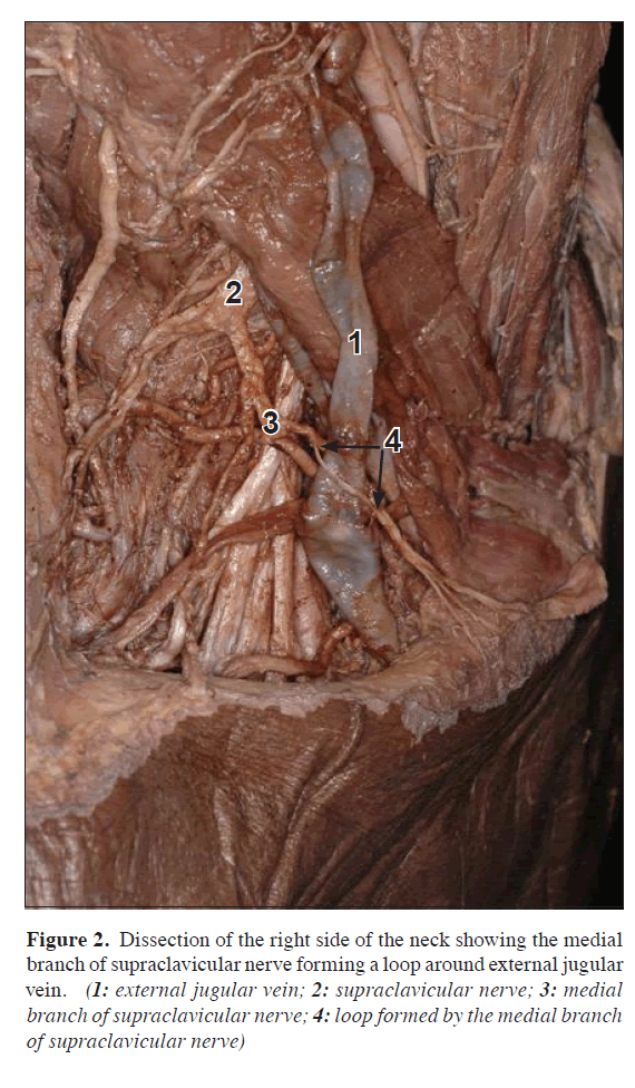 anatomical-variations-external-jugular