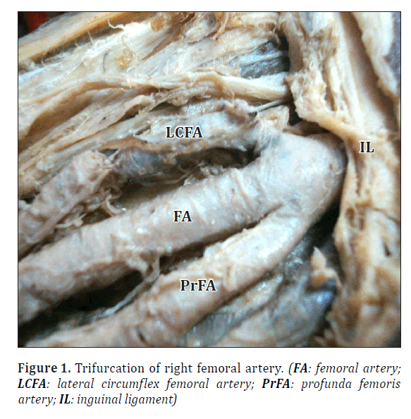 anatomical-variations-femoral-artery