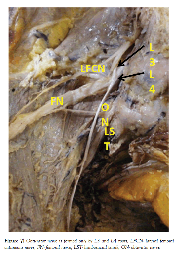 anatomical-variations-femoral-nerve