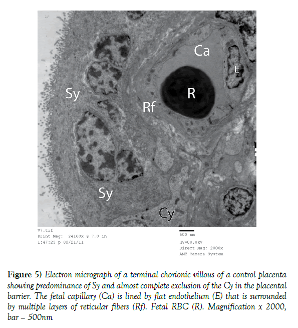 anatomical-variations-fetal-capillary