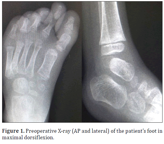 anatomical-variations-foot-maximal