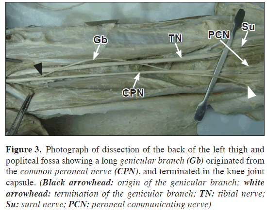 anatomical-variations-genicular