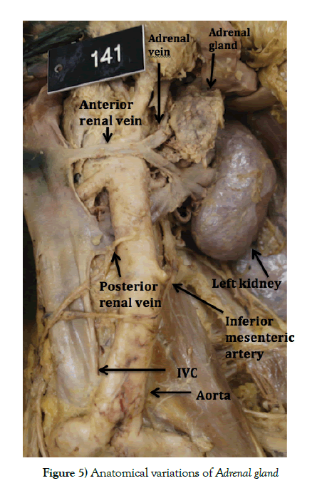 anatomical-variations-gland