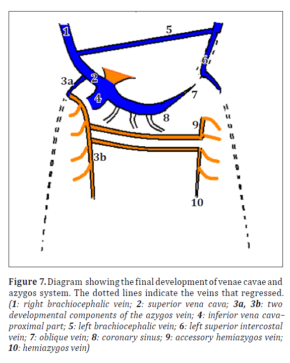 anatomical-variations-hemiazygos-vein