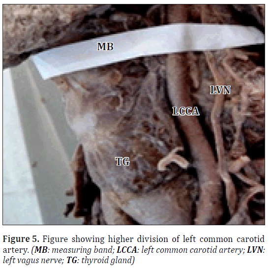 anatomical-variations-higher-division