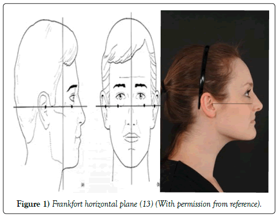 anatomical-variations-horizontal-plane