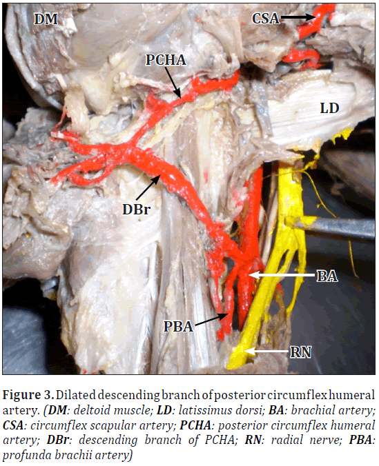 anatomical-variations-humeral-artery