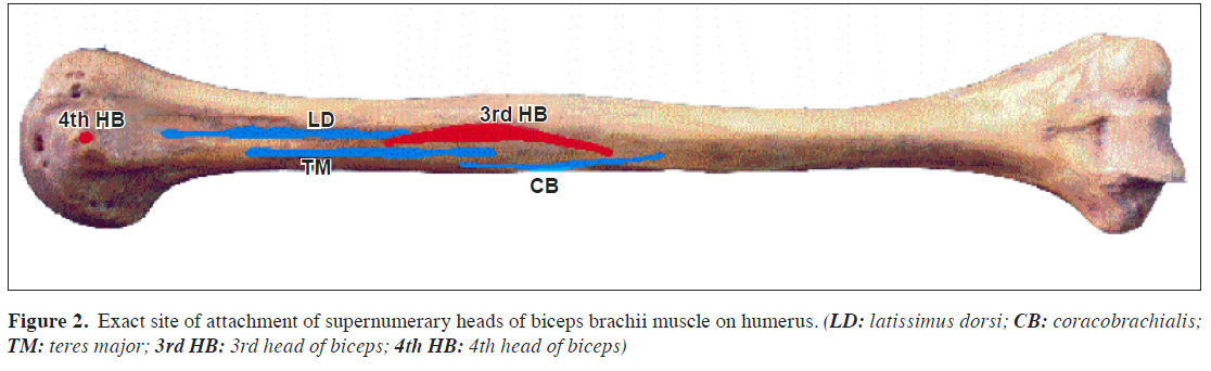 anatomical-variations-humerus