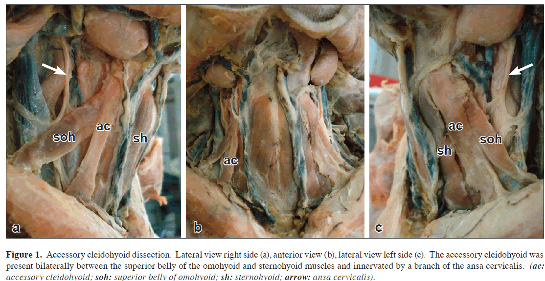 anatomical-variations-inferior