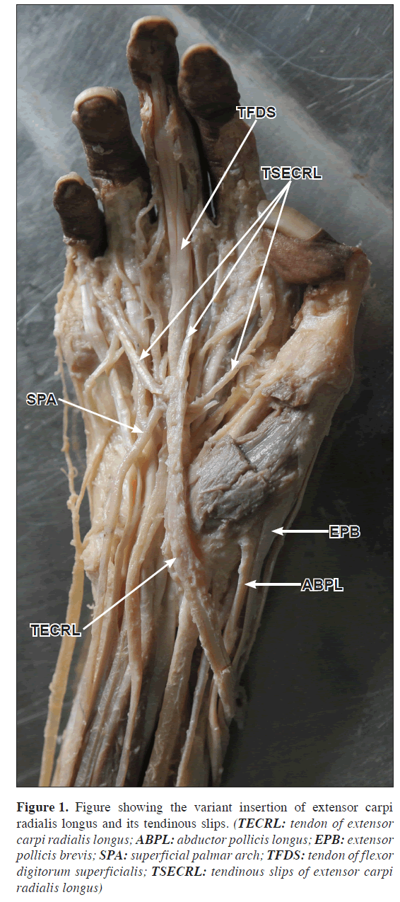 anatomical-variations-insertion-extensor