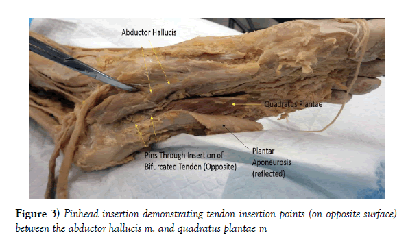 anatomical-variations-insertion-points