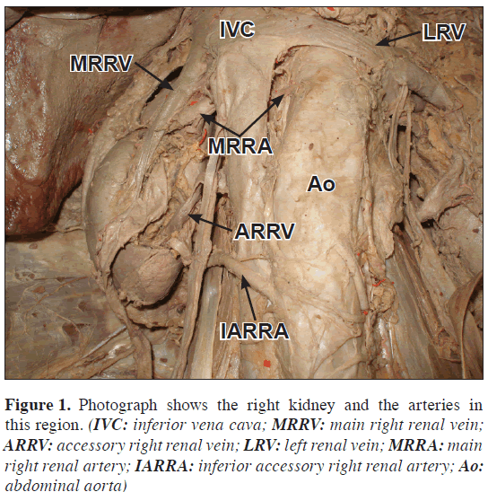 anatomical-variations-kidney