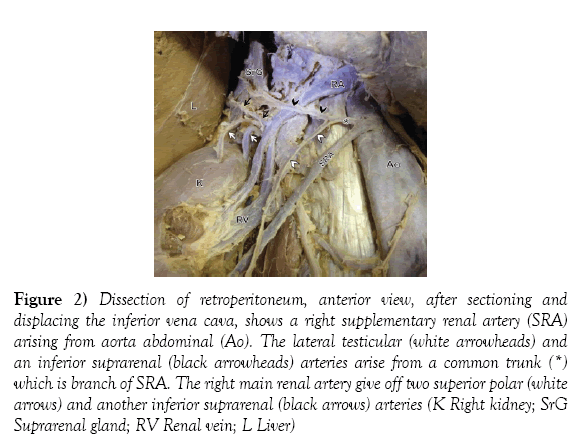 anatomical-variations-lateral-testicular