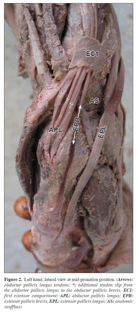 anatomical-variations-lateral-view